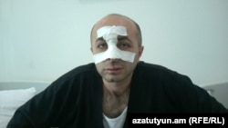 Լեռնային Ղարաբաղ - Պատգամավոր Հայկ Խանումյանը ծեծից հետո Ստեփանակերտի հիվանդանոցում, 7-ը հունիսի, 2016թ․