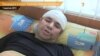 Кандидата в мери Харкова побили невідомі
