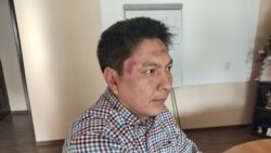 Болот Темировдун сабалгандан кийинки сүрөтү. 9-январь, 2020-жыл.