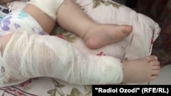 Мудассир Каримов баъди ҷарроҳӣ
