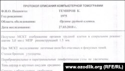 Экспертиза калтакланиш белгилари йўқ, деб хулоса чиқарган.